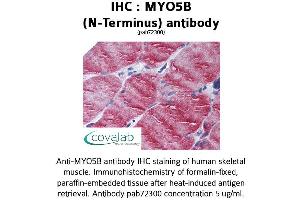 Image no. 1 for anti-Myosin VB (MYO5B) antibody (ABIN1737170) (MYO5B anticorps)