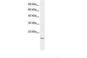 Image no. 2 for anti-BCL2-Associated X Protein (BAX) (N-Term) antibody (ABIN202051) (BAX anticorps  (N-Term))
