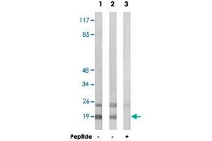 Western blot analysis of extracts from HepG2 cells (Lane 1 and lane 3) and HeLa cells (Lane 2), using RPL12 polyclonal antibody . (RPL12 anticorps)