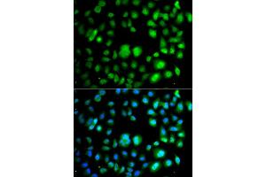 Immunofluorescence analysis of A549 cells using TET3 antibody. (TET3 anticorps)