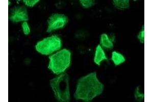 Anti-RASSF1 mouse monoclonal antibody (ABIN2454254) immunofluorescent staining of COS7 cells transiently transfected by pCMV6-ENTRY RASSF1 (RC213525). (RASSF1 anticorps)