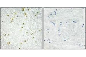 Immunohistochemistry analysis of paraffin-embedded human brain tissue, using SNAPC5 Antibody.