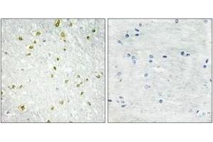 Immunohistochemistry analysis of paraffin-embedded human brain tissue, using SNAPC5 Antibody. (SNAPC5 anticorps  (AA 10-59))