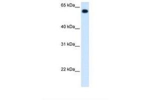 Image no. 2 for anti-Aldehyde Dehydrogenase 4 Family, Member A1 (ALDH4A1) (C-Term) antibody (ABIN320974)
