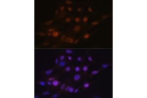 Immunofluorescence analysis of C6 cells using B Rabbit mAb (ABIN7265377) at dilution of 1:100 (40x lens). (ANP32B anticorps)