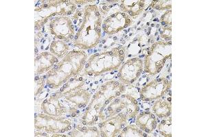 Immunohistochemistry of paraffin-embedded rat kidney using RNF166 antibody (ABIN6135036, ABIN6147021, ABIN6147024 and ABIN6224290) (40x lens).