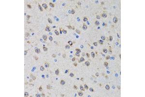 Immunohistochemistry of paraffin-embedded rat brain using PGRMC1 antibody (ABIN1876820) at dilution of 1:100 (40x lens). (PGRMC1 anticorps)