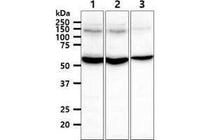 The cell lysates (40ug) were resolved by SDS-PAGE, transferred to PVDF membrane and probed with anti-human TXNRD1 antibody (1:1000). (TXNRD1 anticorps)