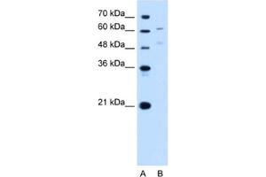 Western Blotting (WB) image for anti-UDP Glucuronosyltransferase 1 Family, Polypeptide A4 (UGT1A4) antibody (ABIN2463019) (UGT1A4 anticorps)