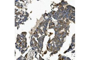 IHC analysis of ME2 using anti-ME2 antibody (ABIN7600967). (NAD-ME anticorps  (AA 26-584))