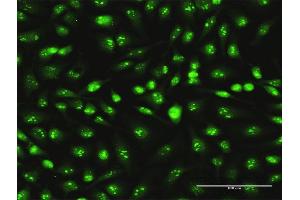 Immunofluorescence of monoclonal antibody to SKP1 on HeLa cell. (SKP1 anticorps  (AA 53-160))