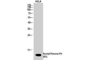 Western Blotting (WB) image for anti-Histone H4 (acLys5) antibody (ABIN3181870) (Histone H4 anticorps  (acLys5))