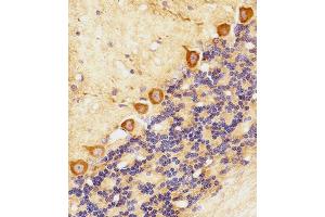 Immunohistochemical analysis of paraffin-embedded R. (CHML anticorps  (C-Term))