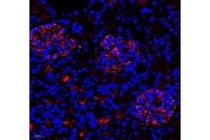Immunofluorescence of paraffin embedded rat kidney using mcp5 (ABIN7073445) at dilution of 1:400 (400x lens)
