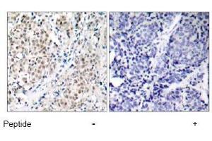 Image no. 1 for anti-Myc Proto-Oncogene protein (MYC) (Thr358) antibody (ABIN197156) (c-MYC anticorps  (Thr358))