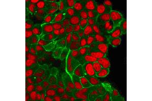 Flow Cytometric Analysis of trypsinized PFA-fixed MCF-7 cells.