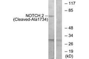 Western blot analysis of extracts from Jurkat cells, treated with etoposide 25uM 24h, using NOTCH2 (Cleaved-Ala1734) Antibody. (NOTCH2 anticorps  (Cleaved-Ala1734))