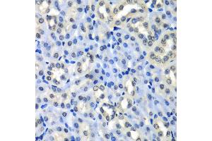 Immunohistochemistry of paraffin-embedded mouse kidney using H2AFZ antibody at dilution of 1:100 (x40 lens).