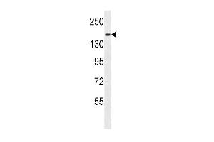 PCDH9 Antibody (C-term) (ABIN657109 and ABIN2837896) western blot analysis in MDA-M cell line lysates (35 μg/lane).