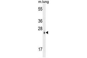 CEBPD Antibody (N-term) western blot analysis in mouse lung tissue lysates (35µg/lane).