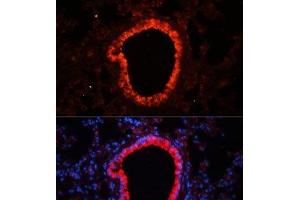 Immunofluorescence analysis of Mouse lung using NLRC4 Polyclonal Antibody