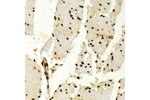 Immunohistochemistry of paraffin-embedded Human esophageal using KPNA4 antibody at dilution of 1:100 (x400 lens).