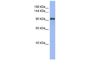 WB Suggested Anti-LAntibody Titration:  0. (LARP1 anticorps  (N-Term))