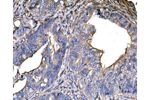 IHC analysis of SNAP23 using anti-SNAP23 antibody (ABIN7603236). (SNAP23 anticorps  (N-Term))