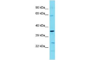 Host: Rabbit  Target Name: Tbc1d7  Sample Tissue: Mouse Stomach lysates  Antibody Dilution: 1. (TBC1D7 anticorps  (C-Term))