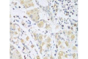 Immunohistochemistry of paraffin-embedded Human stomach using SGCB Polyclonal Antibody at dilution of 1:100 (40x lens). (SGCB anticorps)
