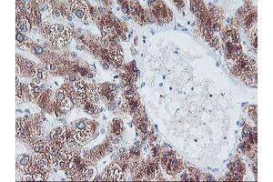 Immunohistochemical staining of paraffin-embedded Human liver tissue using anti-FBXO21 mouse monoclonal antibody. (FBXO21 anticorps)