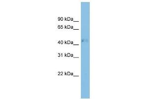 RRAGD antibody used at 1 ug/ml to detect target protein. (RRAGD anticorps  (Middle Region))