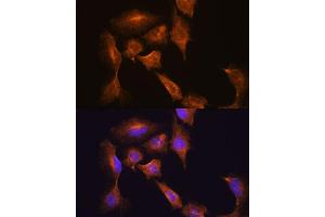 Immunofluorescence analysis of C6 cells using HOOK3 antibody (ABIN7267781) at dilution of 1:100. (HOOK3 anticorps  (AA 489-718))