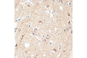 Immunohistochemistry of paraffin-embedded human brain using DCR2 Rabbit mAb (ABIN7271063) at dilution of 1:100 (40x lens).