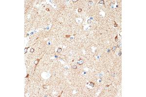 Immunohistochemistry of paraffin-embedded human brain using DCR2 Rabbit mAb (ABIN7271063) at dilution of 1:100 (40x lens). (DcR2 anticorps)