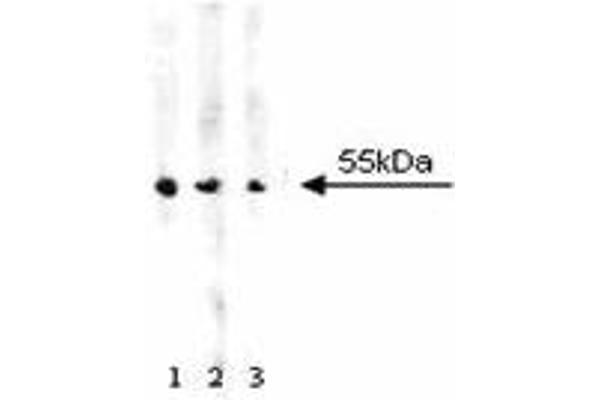 Aldehyde Dehydrogenase anticorps  (AA 7-128)