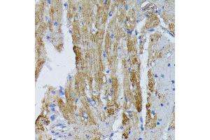 Immunohistochemistry of paraffin-embedded mouse heart using ACADL antibody (ABIN1678519, ABIN3015429, ABIN3015430 and ABIN6216381) at dilution of 1:100 (40x lens).