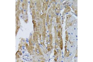 Immunohistochemistry of paraffin-embedded mouse heart using ACADL antibody (ABIN1678519, ABIN3015429, ABIN3015430 and ABIN6216381) at dilution of 1:100 (40x lens). (ACADL anticorps  (AA 31-210))