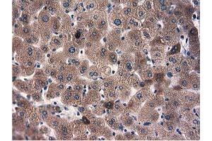 Immunohistochemical staining of paraffin-embedded Human thyroid tissue using anti-L1CAM mouse monoclonal antibody. (L1CAM anticorps)