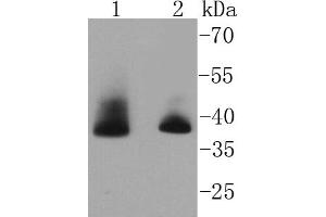 Lane 1: Hela, Lane 2: MCF-7 cell lysate probed with Aurora B (1G9) Monoclonal Antibody  at 1:1000 overnight at 4˚C. (Aurora Kinase B anticorps)