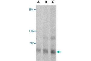 Western blot analysis of GRIK4 in rat brain tissue lysate with GRIK4 polyclonal antibody  at (A) 0. (GRIK4 anticorps  (N-Term))