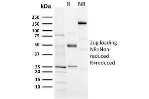 SDS-PAGE Analysis Purified Aurora B Rabbit Recombinant Monoclonal (AURKB/3121R).