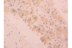 DAB staining on IHC-P; Samples: Human Liver Tissue (SIGLEC9 anticorps  (AA 23-142))