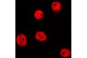 ABIN6275684 staining Hela by IF/ICC. (ZBTB40 anticorps  (Internal Region))