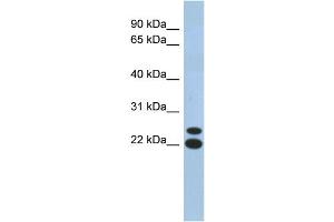 WB Suggested Anti-C19orf54 Antibody Titration: 0. (C19orf54 anticorps  (N-Term))
