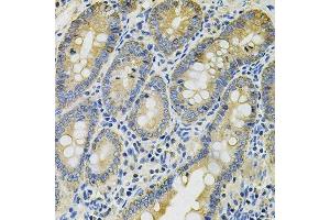 Immunohistochemistry of paraffin-embedded rat intestine using KRT20 Antibody. (KRT20 anticorps  (AA 245-424))