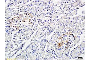 Formalin-fixed and paraffin embedded: rat pancreas tissue labeled with Anti-PP-1B Polyclonal Antibody (ABIN725465), Unconjugated at 1:300 followed by conjugation to the secondary antibody and DAB staining (PPP1CB anticorps  (AA 155-250))