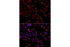 Immunofluorescence analysis of A549 cells using SLC22A11 antibody. (SLC22A11 anticorps  (AA 40-150))