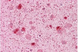 Human brain; Immunohistochemistry with Brain, cortex tissue at an antibody concentration of 5ug/ml using anti-GSH2 antibody ; GSH2 antibody - N-terminal region in Human brain cells using Immunohistochemistry (GSX2 anticorps  (N-Term))