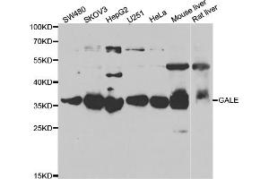 Western blot analysis of extracts of various cell lines, using GALE antibody (ABIN5973962) at 1/1000 dilution. (GALE anticorps)